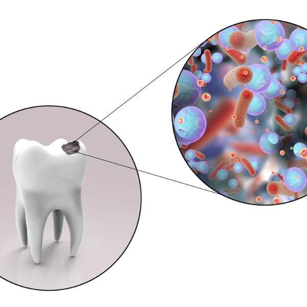 urgence dentaire 2 - centre dentaire rosemere